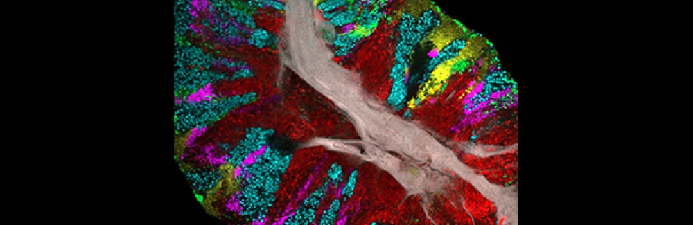 Bacterial biofilm scraped from the surface of the tongue and imaged using CLASI-FISH.