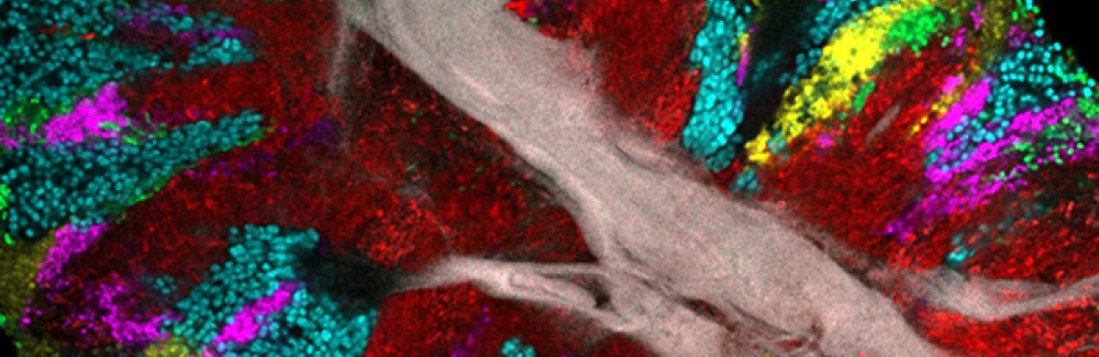 Bacterial biofilm scraped from the surface of the tongue and imaged using CLASI-FISH.
