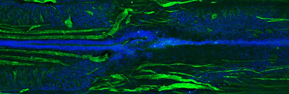 Longitudinal section of a lamprey spinal cord at 11 weeks post-injury