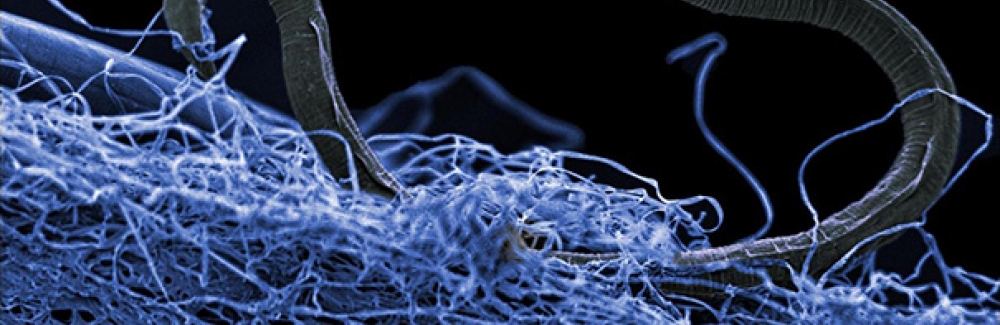 A nematode (eukaryote) in a biofilm of microorganisms.