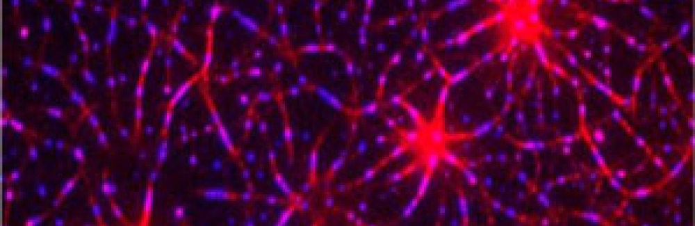 Assembly of a T-cell receptor pathway in vitro using 12 purified components on model membranes. An actin network (red) was induced by LAT clustering (blue).