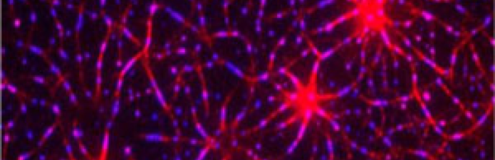 Assembly of a T-cell receptor pathway in vitro using 12 purified components on model membranes. An actin network (red) was induced by LAT clustering (blue). 