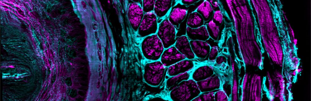 mouse esophageal tissue