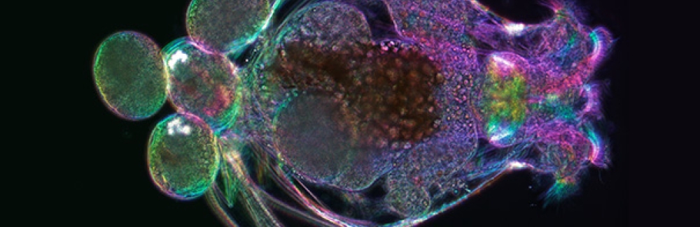 A female Brachionus manjavacas rotifer, carrying four large eggs.
