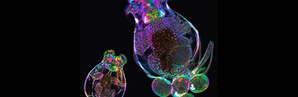 Mother rotifer (Brachionus manjavacas) carrying four eggs (right) and newly-hatched daughter (left). Image of live rotifers acquired using polychromatic polarization and phase contrast.