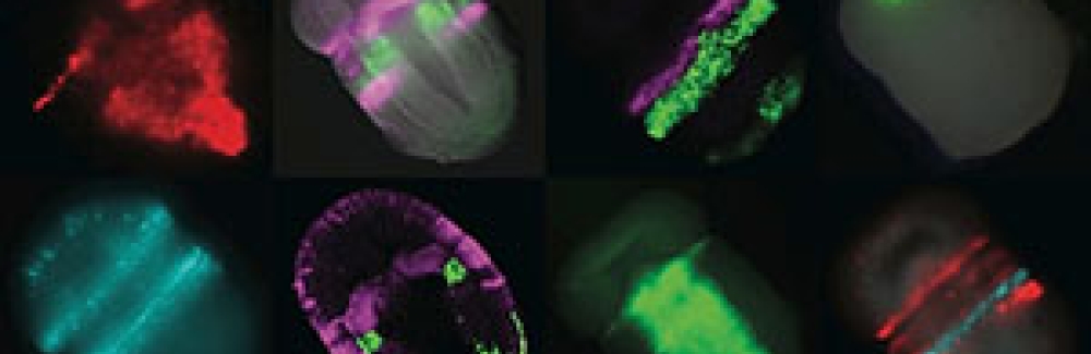 Gene activity in the acorn worm embryo. 