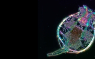 Rotifer. Credit: Kristin Gribble and Michael Shribak | Equipment: Polychromatic Polscope