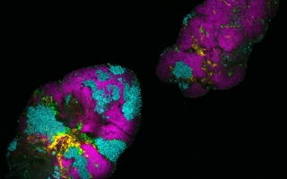 Bacterial biofilm from a human tongue