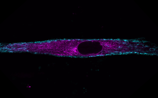 Myoblasts (muscle cells) from mice offer a window into the function of nuclear movement. Credit: Raquel Pereira (@Pereira_ARR)