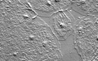 C. hemispherica jellyfish cells caught in the act of re-sealing a wound. Credit: Jocelyn Malamy 