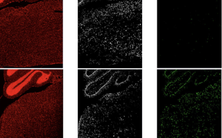 Rett Syndrome in mice brainstem