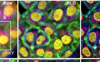 Images-of-human-cancer-cells-processed-with-Richardson-Lucy-Deconvolution---a-panel----and-a-neural-network-that-uses-RLD-Credit-Li-et-al-Nature-Methods-2022