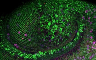 Stentor pyriformis image