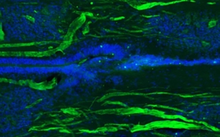 Eleven weeks after being cut, a lamprey’s spinal cord shows regrowth of some of its nerve fibres (green) and the tube-like central canal (blue). Credit: S. Allen and J. Morgan