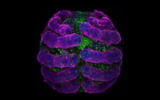 Parasteatoda tepidariorum (spider embryo) stained for embryo surface (pink), nuclei (blue) and microtubules (green). Credit: Tessa Montague