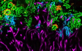 This dental plaque structure, dubbed “hedgehog” for its appearance, shows several genera of bacteria: Corynebacterium (magenta), Porphyromonas (cyan), Streptococcus (green), and Haemophilus/Aggregatibacter (orange).