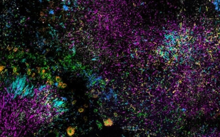 This image from the Mark Welch laboratory shows structured consortia of microbes in dental plaque.