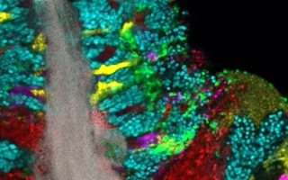 Bacterial biofilm scraped from the surface of the tongue and imaged using CLASI-FISH. Credit: Steven Wilbert and Gary Borisy, The Forsyth Institute