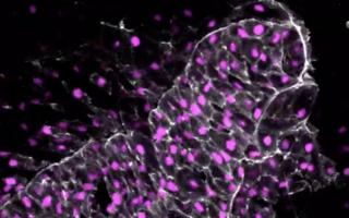 The cellular skeletal protein actin (grey) marks the cell edges and the nucleus is is in magenta.