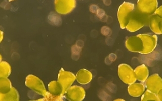 Stentor pyriformis with photosynthetic algae