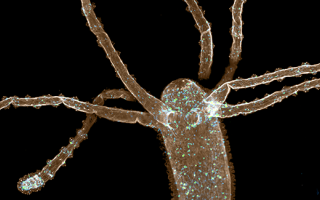 Muscles (sepia) and the nerve net (blue and green) are tagged in this hydra image.