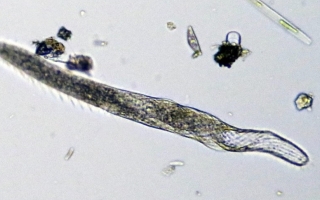 Ciliate Spirostomum ambiguum