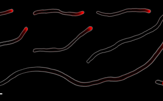 Cellular elongation at the tips of the filamentous bacteria Corynebacterium matruchotii. Credit: Chimileski et al (2024).