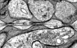 axon