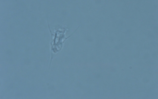 protist