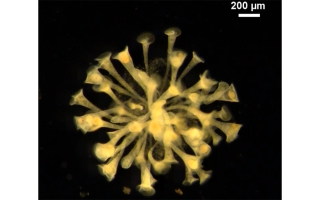 stentor colony