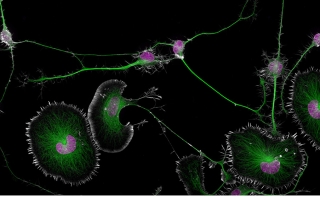 mouse brain cells