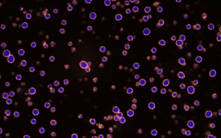 condensates - paraspeckles
