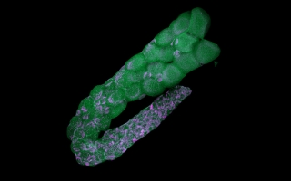 ostracod ovarium with endosymbiotic bacteria