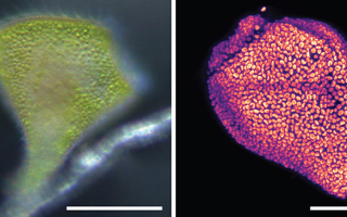 Stentor stipatus contains endosymbiotic algae, the green of which mixes with a dark pigment to give the species a reddish-brown color. Left: Dense cortical packing of algal cells in the S. stipatus cell. Right: Autofluorescence of the algae. Scale bar approx. 100 microns. 