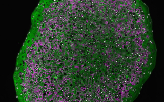 Round cross sectional image of an pearl shaped organoid with some cells stained green and others purple.