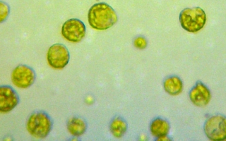 Algae under a microscope 