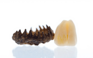 Fish scale next to a human tooth for comparison