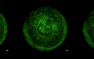 This photo shows three side-by-side microscopy photos (all the same) of a green zebrafish membrane.
