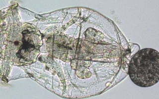 A rotifer under the microscope