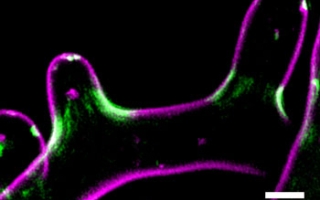 The filamentous fungus Ashbya gossypii. The plasma membrane is visualized in magenta (FM-464), and the septin Cdc11a-GFP is in green.