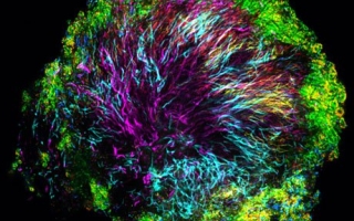 A “hedgehog” structure in dental plaque, collected from a healthy volunteer using a toothpick. Corynebacteria, shown in magenta, form the core of the structure; other bacteria inhabit the structure at characteristic positions.