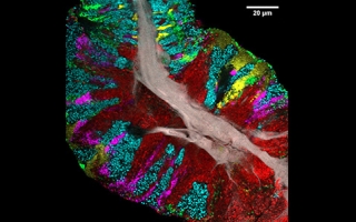 Bacterial biofilm scraped from the surface of the tongue and imaged using CLASI-FISH.