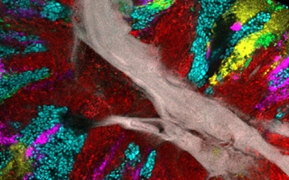 Bacterial biofilm scraped from the surface of the tongue and imaged using CLASI-FISH.