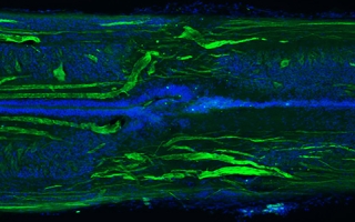 Longitudinal section of a lamprey spinal cord at 11 weeks post-injury