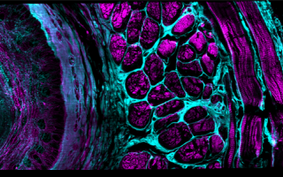 mouse esophageal tissue