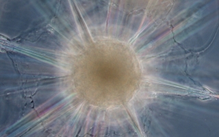 Astrolithium, a marine microbe taken from a sedimented sample of seawater near Woods Hole, Mass. 
