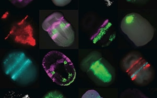 Gene activity in the acorn worm embryo. 