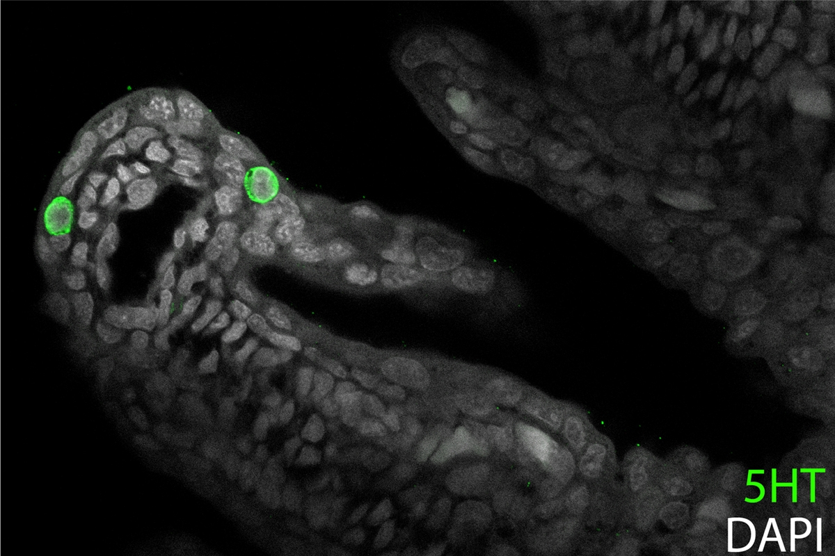 Hypoxia-sensitive NECs from the gills of an embryonic skate are recognisable by their expression of serotonin (5HT).