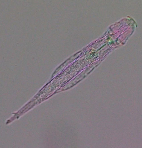 Bdelloid rotifer (Adineta vaga) under polychromatic polarization microscope.