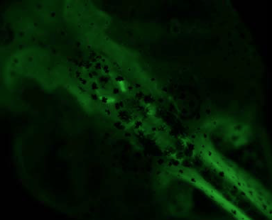 Xtr.Et(eef1a1:GFP)cenMead